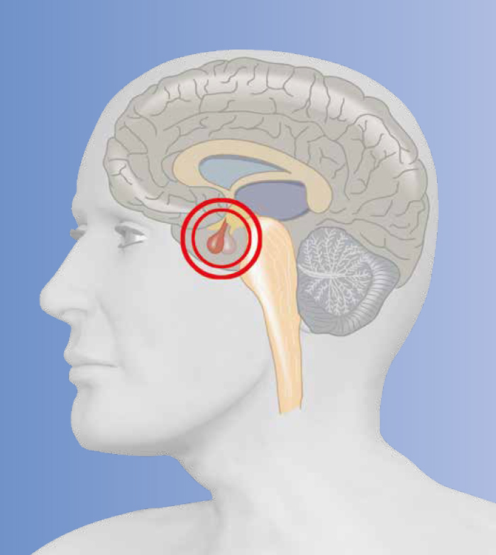 Die medizinische Illustration zeigt eine Seitenansicht des menschlichen Kopfes mit einem Querschnitt des Gehirns. Hervorgehoben ist die Hypophyse (Hirnanhangsdrüse), die durch einen roten Kreis markiert ist. Sie befindet sich zentral im Gehirn, unterhalb des Hypothalamus. Die übrigen Gehirnstrukturen – wie Großhirnrinde, Balken und Kleinhirn – sind in Grau- und Beigetönen dargestellt.